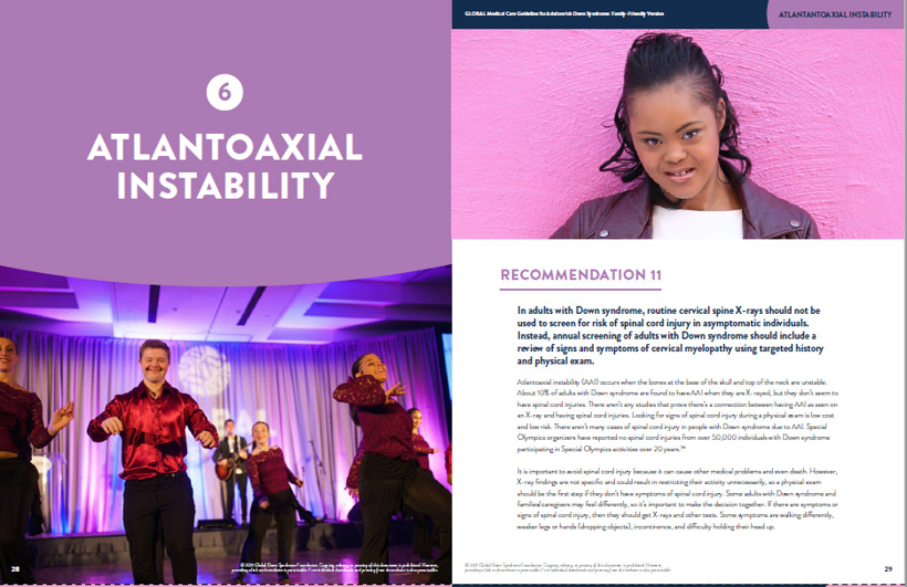 Atlantoaxial Instability spread